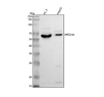 Western blot analysis of MFSD4A using anti-MFSD4A antibody. Lane 1: human PC-3 whole cell lysates, L