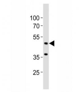 Eed Antibody