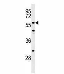 Western blot analysis of CDC25C antibody and NIH3T3 lysate. Expected molecular weight: ~53/60 kDa (u