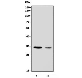 CDR1 Antibody / Cerebellar degeneration-related antigen 1