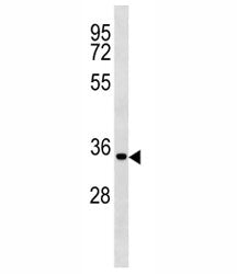 Cyclin D2 Antibody (CCND2)