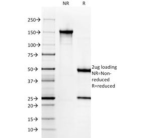 SDS-PAGE analysis of purified, BSA-free Gastrin antibody (clone GAST/2631) as confirmation of integr