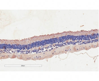 IHC testing of FFPE human retinal with CNGB3 antibody at 2ug/ml. Staining of the pigmented epithelia