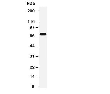 Western blot testing of Serotonin transporter antibody and rat brain tissue lysate. Expected molecul