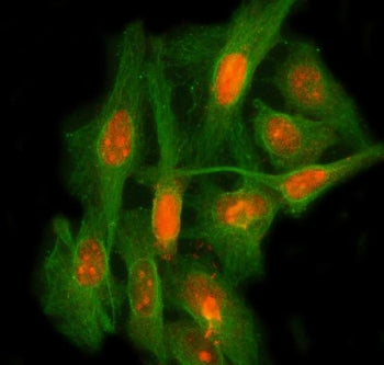 Immunofluorescent staining of FFPE human HeLa cells with LEO1 antibody (red) and Beta Tubulin mAb (g