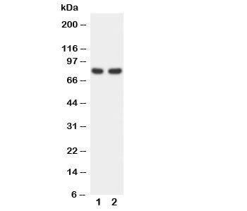 Western blot testing of FOXP1 antibody and Lane 1: rat spleen; 2: COLO320 cell lysate. Predicted/obs
