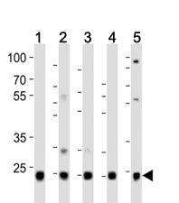 Ubiquitin Antibody