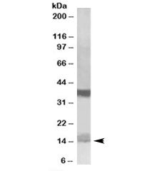 Prefoldin Antibody