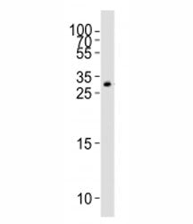 GDF15 Antibody