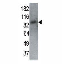 MARK1 antibody used in western blot to detect MARK1 in P7 mouse whole brain lysate (60 ug) at 1:250.
