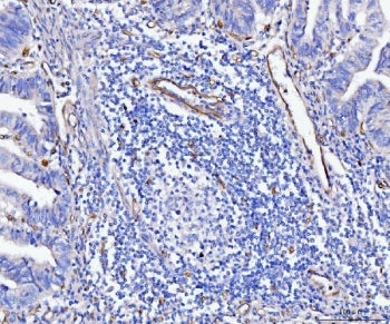 CD93 Antibody