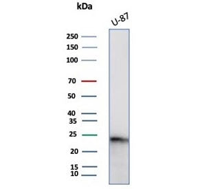 CSF3 Antibody / Granulocyte-Colony Stimulating Factor