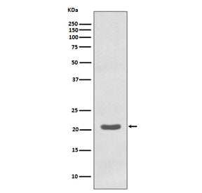 Western blot testing of human K562 cell lysate with MTCO2 antibody. Predicted molecular weight ~25 k