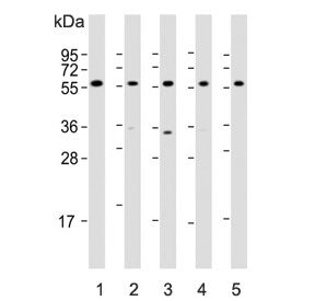 Western blot testing of human 1) HepG2, 2) Li-7, 3) U-87 MG, 4) testis and 5) mouse testis lysate wi