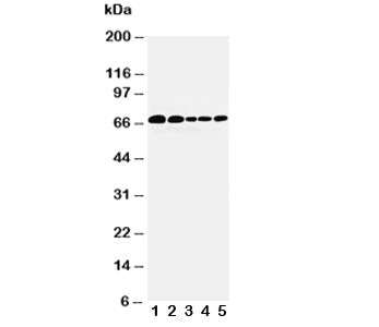 Western blot testing of Paxillin antibody and Lane 1: 293T; 2: HeLa; 3: MCF-7; 4: MM231; 5: Jurkat c