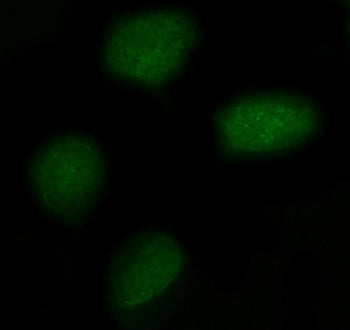 Immunofluorescent staining of FFPE human U-2 OS cells with FAM55C antibody (green). HIER: steam sect