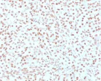 IHC testing of FFPE human pancreas with AKT1 antibody (clone RASTPK-1). HIER: boil tissue sections i