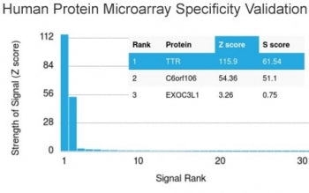 Analysis of HuProt(TM) microarray containing more than 19,000 full-length human proteins using Preal