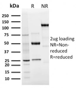 Langerin Antibody / CD207