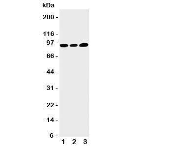 Western blot testing of TRPV3 antibody and Lane 1: HeLa; 2: A549; 3: MCF-7 cell lysate. Predicted/ob