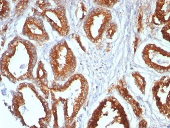 IHC staining of FFPE human prostate tissue with CD107a antibody (clone LAMP1/7456). HIER: boil tissu