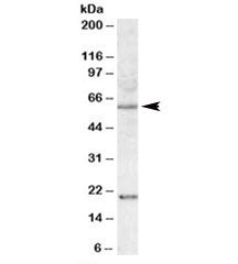 Western blot testing of HEK293 lysate with SODD antibody at 1ug/ml. Predicted molecular weight: ~50 