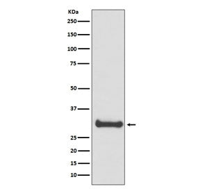 Western blot testing of human fetal brain lysate with Calbindin antibody. Predicted molecular weight