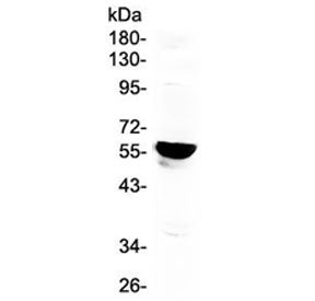Western blot testing of human placenta lysate with CYP19A1 antibody at 0.5ug/ml. Predicted molecular