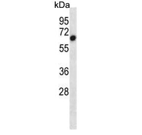 Western blot testing of mouse bladder tissue lysate with ALK2 antibody. Predicted molecular weight ~