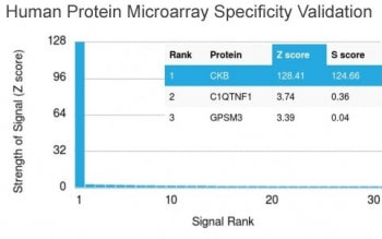 Analysis of HuProt(TM) microarray containing more than 19,000 full-length human proteins using Creat