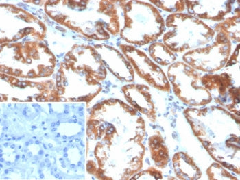 IHC staining of FFPE human kidney tissue with Phospholipase A2 Receptor 1 antibody (clone PLA2R1/489