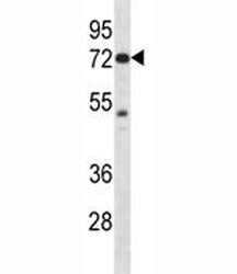 Pak4 Antibody