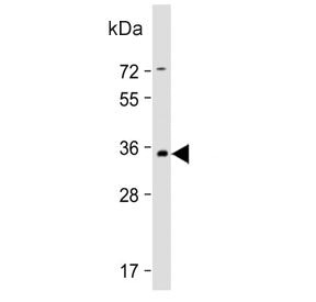 Western blot testing of human brain tissue lysate with PRRT2 antibody. Predicted molecular weight ~3