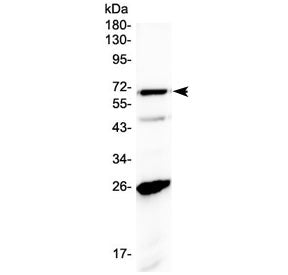 Western blot testing of human A431 cell lysate with SLC7A3 antibody at 0.5ug/ml. Predicted molecular