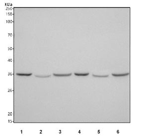 Western blot testing of 1) rat heart, 2) rat skeletal muscle, 3) rat kidney, 4) mouse heart, 5) mous