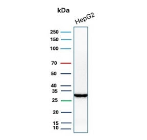 Western blot testing of human HepG2 cell lysate with Succinate dehydrogenase B antibody. Predicted m