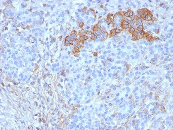 IHC staining of FFPE human pancreas tissue with CD99 antibody (clone rMIC2/6939). HIER: boil tissue 