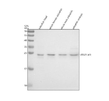 Western blot analysis of UBE2Ka/b protein using Zebrafish Ube2k antibody and 1) zebrafish head, 2) w