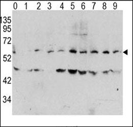 c-Myc Antibody (phospho-T58)