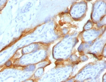 HCG-beta Antibody