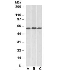Western blot testing of mouse NIH3T3 [A], A549 [B], and HeLa [C] lysates with MMP14 antibody at 1ug/