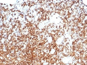 IHC staining of FFPE human tonsil with CD13 antibody (clone APN/6998). HIER: boil tissue sections in