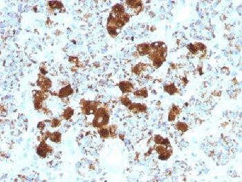 CLIP Antibody / ACTH
