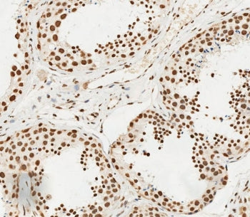 IHC testing of FFPE human testis tissue with HSPA7 antibody. HIER: steam section in pH6 citrate buff