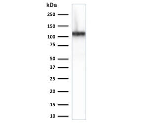Western blot testing of human kidney lysate with Cadherin 16 antibody (clone CDH16/2125). Expected m
