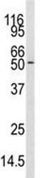 Western blot analysis of CAMKK antibody and mouse cerebellum tissue lysate. Predicted molecular weig