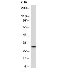 Western blot analysis of human spleen lysate and Kappa antibody (clone KC3L-1). Expected molecular w