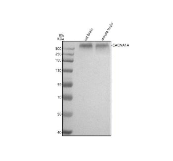 Western blot analysis of CACNA1A using anti-CACNA1A antibody. Lane 1: rat brain tissue lysates, Lane