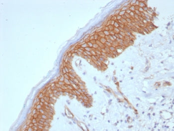 IHC staining of FFPE human skin tissue with Beta-Catenin antibody (clone CTNNB1/8280R). HIER: boil t