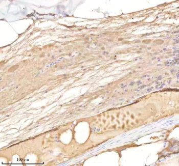 IHC staining of FFPE zebrafish spinal tissue with Rab14 antibody, HRP-labeled secondary and DAB subs